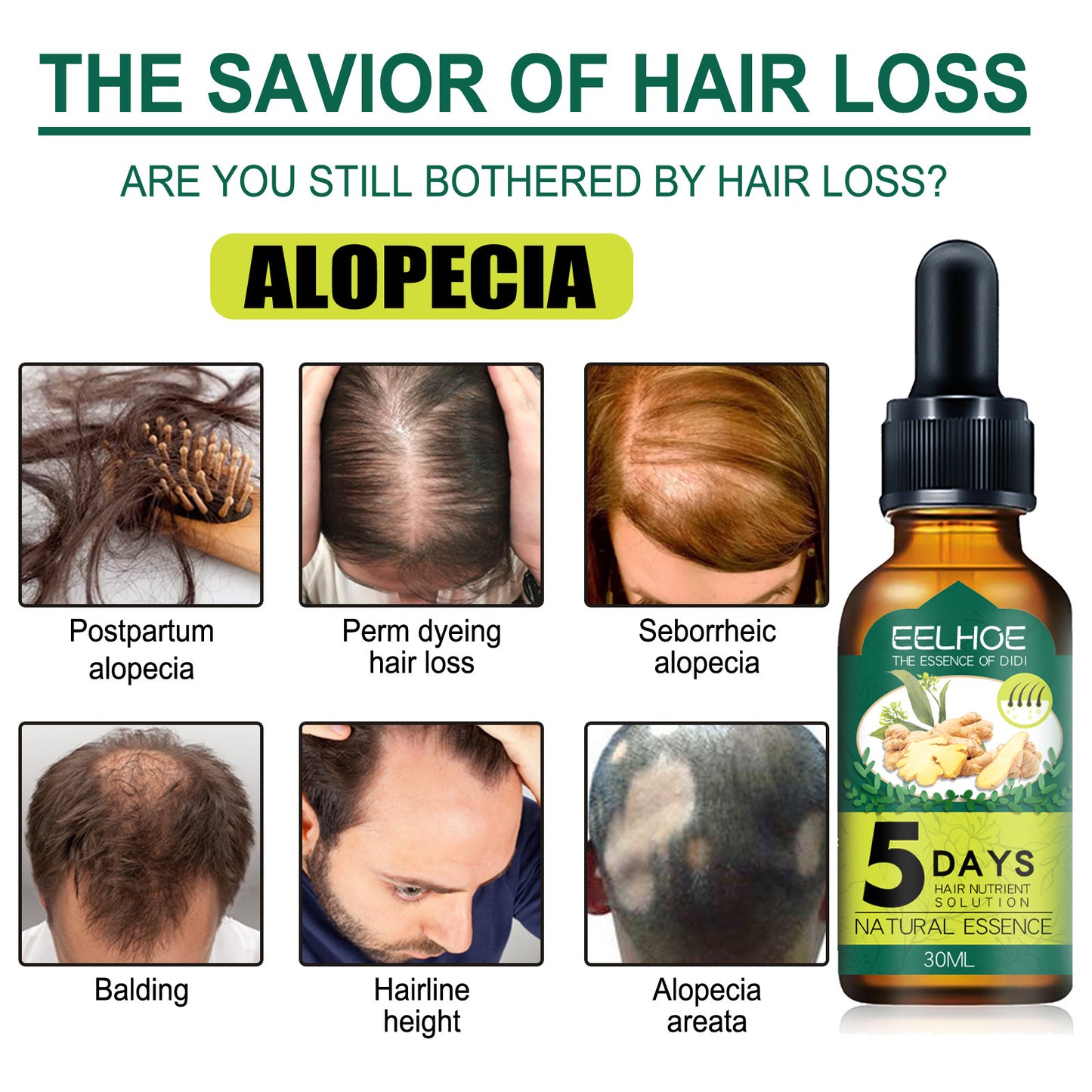 Eelhoe Ginger Hair Essential Oil.