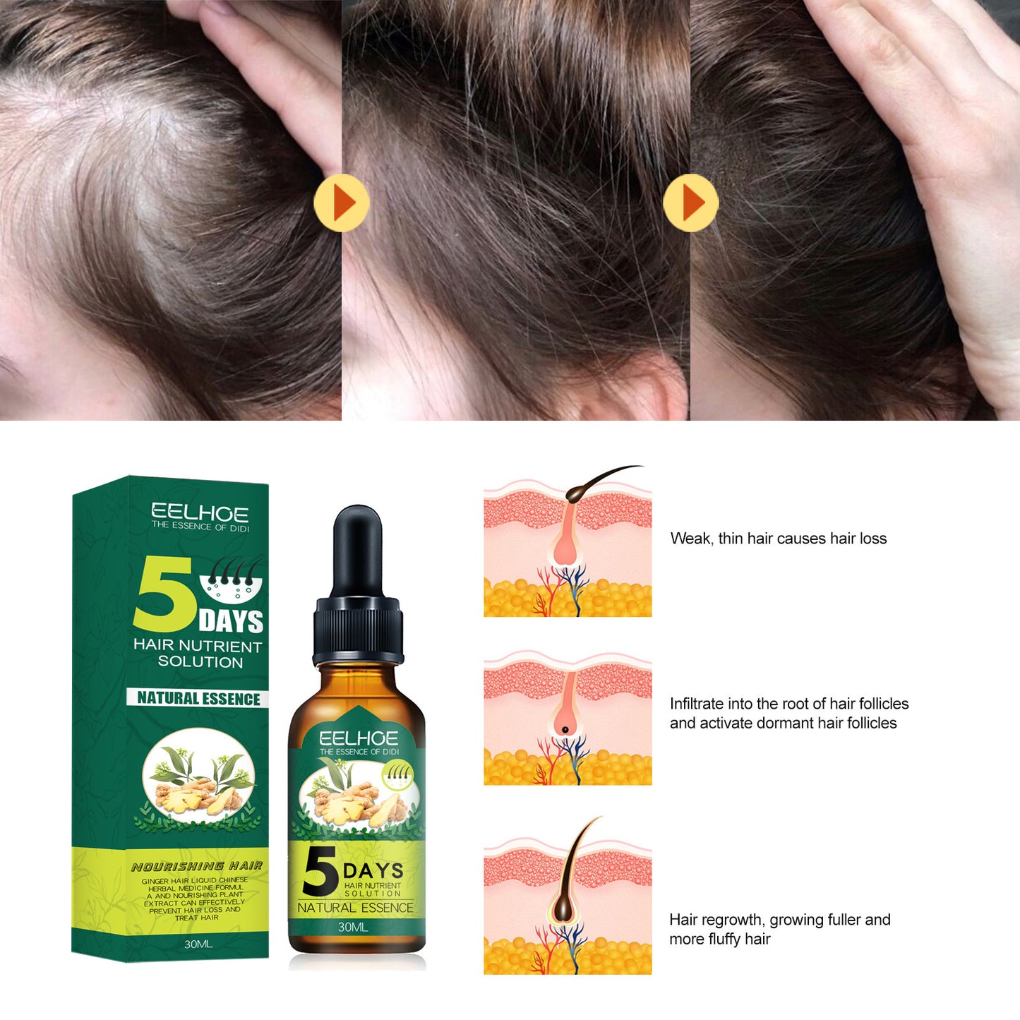 Eelhoe Ginger Hair Essential Oil.