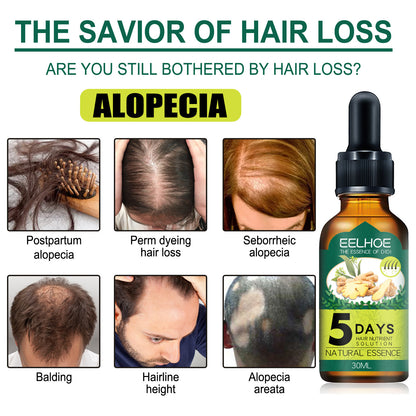 Eelhoe Ginger Hair Essential Oil.